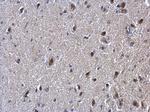 SUFU Antibody in Immunohistochemistry (Paraffin) (IHC (P))