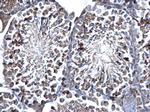 SUFU Antibody in Immunohistochemistry (Paraffin) (IHC (P))