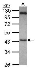 SUFU Antibody in Western Blot (WB)