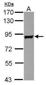 GAB2 Polyclonal Antibody