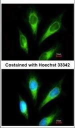Acid Phosphatase 2 Polyclonal Antibody