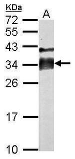 Acrosomal Vesicle Protein Polyclonal Antibody