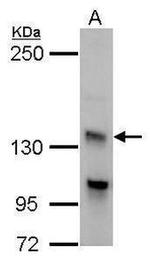 Adenylate Cyclase 7 Antibody in Western Blot (WB)