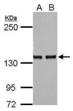 Adenylate Cyclase 7 Antibody in Western Blot (WB)