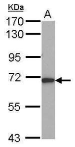 ALAS1 Polyclonal Antibody