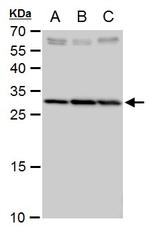 SLC25A6 Polyclonal Antibody
