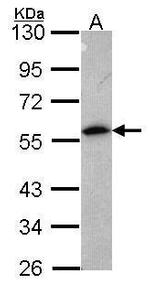 Annexin A11 Polyclonal Antibody