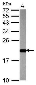 ARF3 Polyclonal Antibody