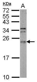 ARL3 Polyclonal Antibody