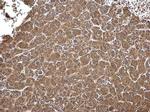 ALDH7A1 Antibody in Immunohistochemistry (Paraffin) (IHC (P))
