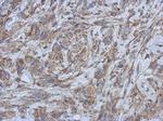 Filensin Polyclonal Antibody
