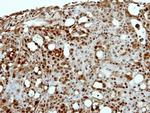 CAPG Antibody in Immunohistochemistry (Paraffin) (IHC (P))