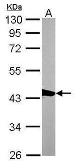 CAPG Antibody in Western Blot (WB)