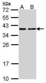 CAPZA2 Polyclonal Antibody