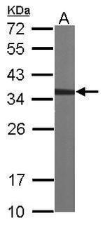 CAPZA2 Antibody in Western Blot (WB)