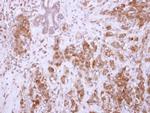 CHAD Polyclonal Antibody