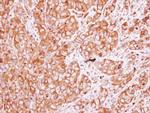 CHRNB1 Antibody in Immunohistochemistry (Paraffin) (IHC (P))