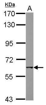CHRNB1 Antibody in Western Blot (WB)