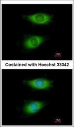 CRIP2 Polyclonal Antibody