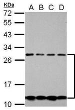 CSH2 Antibody in Western Blot (WB)