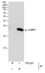CRP1 Antibody in Immunoprecipitation (IP)