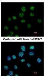CSTF1 Polyclonal Antibody