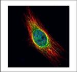 Cathepsin S Polyclonal Antibody