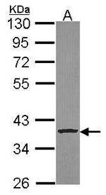 Cathepsin S Antibody in Western Blot (WB)