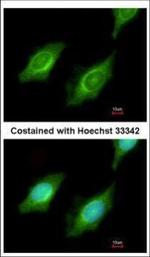 CYP4A11 Polyclonal Antibody