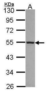 CYP4A11 Antibody in Western Blot (WB)