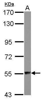 DARS Antibody in Western Blot (WB)