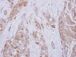 DPH2 Polyclonal Antibody