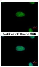 DRIL1 Polyclonal Antibody
