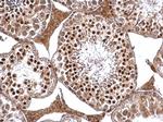 DRIL1 Antibody in Immunohistochemistry (Paraffin) (IHC (P))