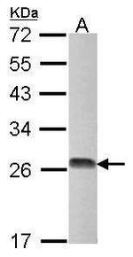 DTYMK Polyclonal Antibody