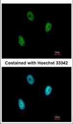 E2F6 Polyclonal Antibody