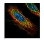 ECH1 Polyclonal Antibody
