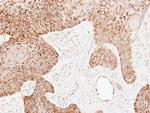 ECH1 Antibody in Immunohistochemistry (Paraffin) (IHC (P))