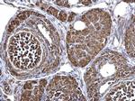 ECHS1 Antibody in Immunohistochemistry (Paraffin) (IHC (P))