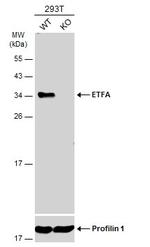 ETFA Antibody in Western Blot (WB)