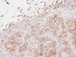 EXTL2 Polyclonal Antibody