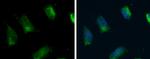 ACSL4 Polyclonal Antibody