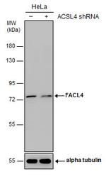 ACSL4 Antibody in Western Blot (WB)