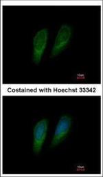 FAH Antibody in Immunocytochemistry (ICC/IF)