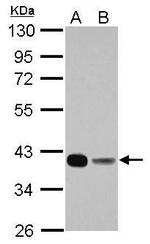 FBP1 Antibody in Western Blot (WB)