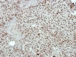 FOXI1 Antibody in Immunohistochemistry (Paraffin) (IHC (P))