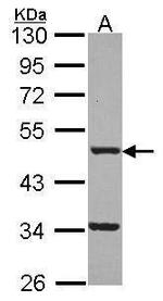 FNTB Polyclonal Antibody
