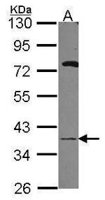 GALE Polyclonal Antibody