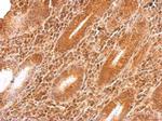 GARS Polyclonal Antibody
