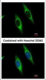 GART Polyclonal Antibody